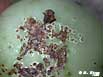 bacterial canker
